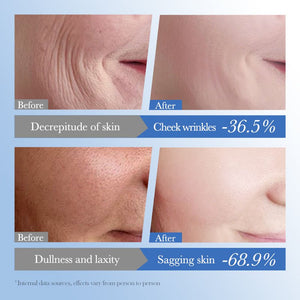 SADOER - Caviar Hyaluronic Acid Anti-Aging Repair Moisturizing Cream